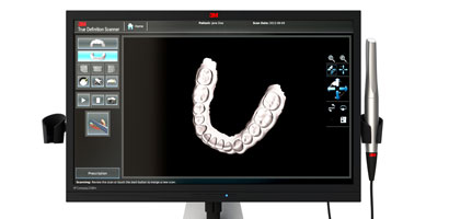 Scanner 3M™ True Definition
