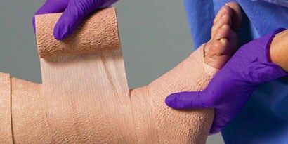 Tratamento de edemas crónicos/linfoedema
