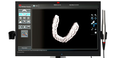 Scanner 3M™ True Definition
