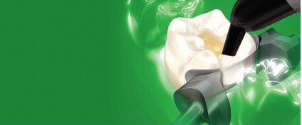 Material de Restauração Filtek™ One Bulk Fill
