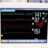 Alarmes de monitorização de ECG